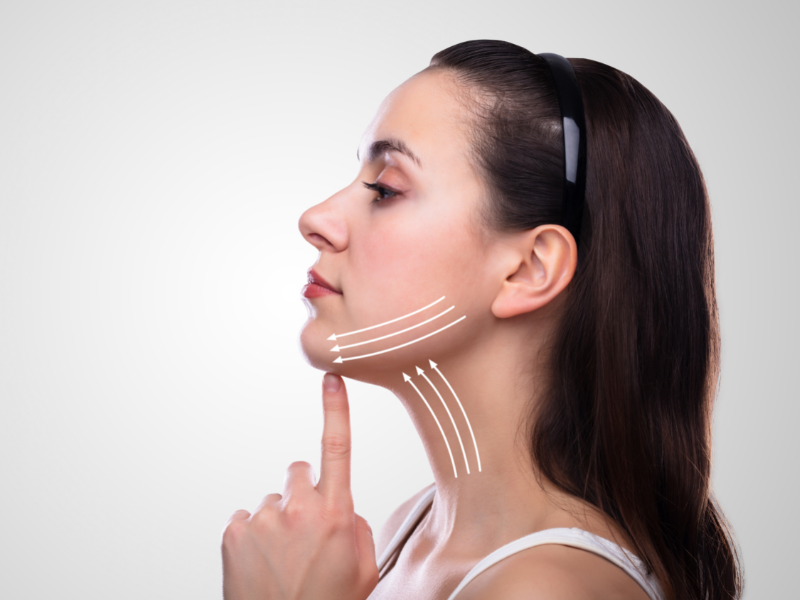 Non Surgical, 8 Point Face Life at Bellora Medical Aesthetics