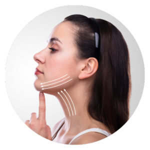 Non-Surgical 8-Point Face Lift at Bellora Medical Aesthetics in Seattle