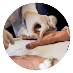 Hand Rejuvenation with Bellora Medical Aesthetics in Seattle with Injector Nurse Beth Myrick
