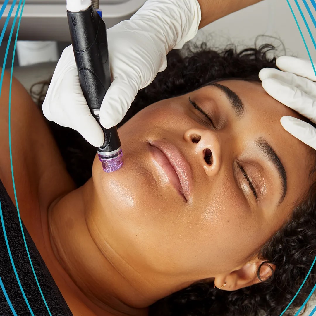 Hydrafacial skin treatment at Bellora Medical Aesthetics in Downtown Seattle