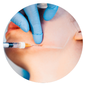 Kybella with Bellora Medical Aesthetics in Seattle with Injector Nurse Beth Myrick